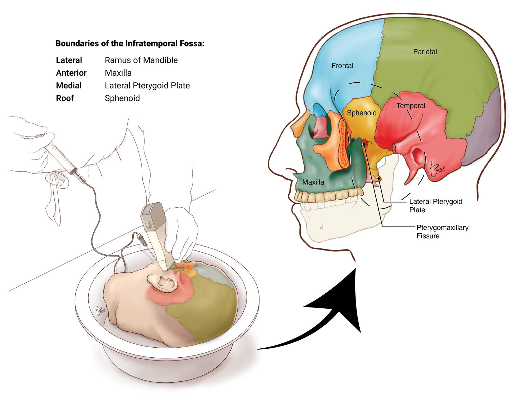 Boundaries of the Infratemporal Fossa – Clip Studio Paint Ex, Adobe Illustrator
